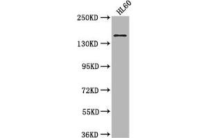 Western Blot Positive WB detected in: HL60 whole cell lysate All lanes: SMARCC2 antibody at 1:2000 Secondary Goat polyclonal to rabbit IgG at 1/50000 dilution Predicted band size: 133, 125, 127 kDa Observed band size: 170 kDa (SMARCC2 antibody  (AA 300-650))