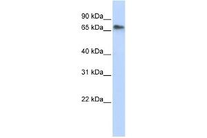 WB Suggested Anti-REPIN1 Antibody Titration:  0. (REPIN1 antibody  (Middle Region))