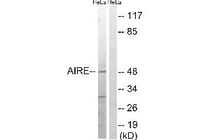 Western blot analysis of extracts from HeLa cells, treated with Hu (2nM, 24hours), using AIRE (Ab-156) antibody. (AIRE antibody  (Ser156))
