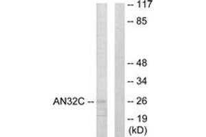Western blot analysis of extracts from HuvEc cells, using ANP32C Antibody. (ANP32C antibody  (AA 121-170))