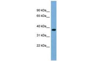 Image no. 1 for anti-Regulation of Nuclear Pre-mRNA Domain Containing 1B (RPRD1B) (AA 143-192) antibody (ABIN6744205) (RPRD1B antibody  (AA 143-192))