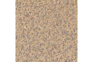 IHC analysis of Citrin/SLC25A13 using anti-Citrin/SLC25A13 antibody (ABIN7599512). (slc25a13 antibody  (AA 1-643))