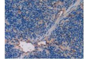 IHC-P analysis of Mouse Spleen Tissue, with DAB staining. (Thrombomodulin antibody  (AA 31-167))