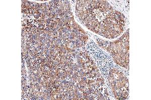 IHC analysis of EML4 using anti-EML4 antibody (ABIN6719384). (EML4 antibody  (AA 207-423))