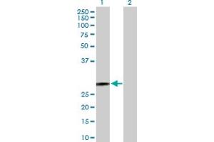 Western Blot analysis of HSD17B10 expression in transfected 293T cell line by HSD17B10 MaxPab polyclonal antibody. (HSD17B10 antibody  (AA 1-261))