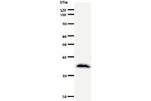 Western Blotting (WB) image for anti-Core-binding Factor, Runt Domain, alpha Subunit 2, Translocated To, 2 (CBFA2T2) antibody (ABIN930909) (CBFA2T2 antibody)