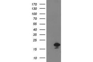 Western Blotting (WB) image for anti-Destrin (Actin Depolymerizing Factor) (DSTN) antibody (ABIN1497908) (Destrin antibody)
