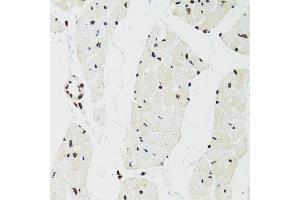 Immunohistochemistry (Paraffin-embedded Sections) (IHC (p)) image for anti-Splicing Factor Proline/glutamine-Ric (SFPQ) (AA 578-707) antibody (ABIN1513519)