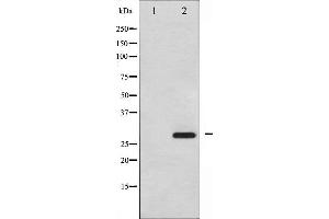 Western blot analysis of HSP27 phosphorylation expression in UV treated HeLa whole cell lysates,The lane on the left is treated with the antigen-specific peptide. (HSP27 antibody  (pSer15))