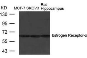 Image no. 1 for anti-Estrogen Receptor 1 (ESR1) (Ser104) antibody (ABIN197215) (Estrogen Receptor alpha antibody  (Ser104))