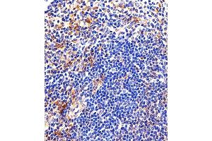 Immunohistochemical analysis of paraffin-embedded M. (LYN antibody  (AA 229-263))