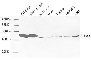 Western blot analysis of tissue and cell lysates using 1 µg/mL Rabbit Anti-NSE Polyclonal Antibody (ABIN398881) The signal was developed with IRDye TM800 Conjugated Goat Anti-Rabbit IgG.