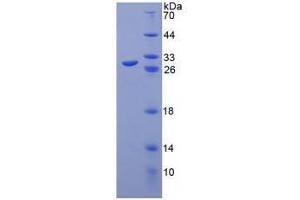 SDS-PAGE analysis of Human Toll Like Receptor 8 Protein.