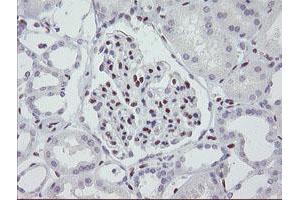 Image no. 1 for anti-Meis Homeobox 3 (MEIS3) (AA 1-261) antibody (ABIN1490670) (MEIS3 antibody  (AA 1-261))