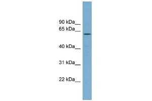 WB Suggested Anti-RIOK2 Antibody Titration: 0. (RIOK2 antibody  (Middle Region))