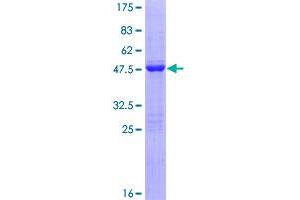 Image no. 1 for Fibroblast Growth Factor 1 (Acidic) (FGF1) (AA 1-155) protein (GST tag) (ABIN1353990) (FGF1 Protein (AA 1-155) (GST tag))