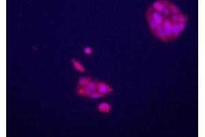 Immunofluorecence staining of anti-GPC3 Pab (cat (ABIN652202 and ABIN2840751)) on HepG2 cells.