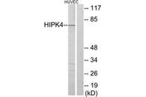 Western blot analysis of extracts from HuvEc cells, using HIPK4 Antibody. (HIPK4 antibody  (AA 511-560))