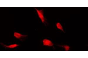 ABIN6267558 staining HeLa by IF/ICC. (HDAC4 antibody  (pSer632))