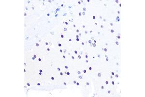 Immunohistochemistry of paraffin-embedded mouse brain using PEG3 Rabbit pAb (ABIN6128527, ABIN6145434, ABIN6145435 and ABIN6216398) at dilution of 1:100 (40x lens). (PEG3 antibody  (AA 1-300))