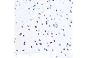 Immunohistochemistry of paraffin-embedded mouse brain using PEG3 Rabbit pAb (ABIN6128527, ABIN6145434, ABIN6145435 and ABIN6216398) at dilution of 1:100 (40x lens).