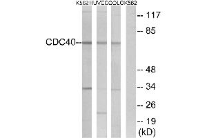 Western blot analysis of extracts from K562 cells, HUVEC cells and COLO cells, using CDC40 antibody.