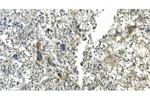 IHC analysis of CDC123 using anti-CDC123 antibody (ABIN7599284). (CDC123 antibody  (AA 1-336))
