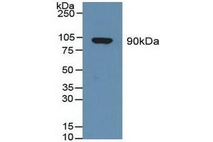 Figure. (Gelsolin antibody  (AA 674-782))