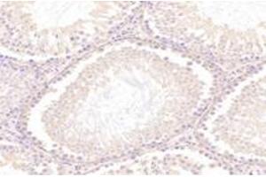 Immunohistochemistry (Paraffin-embedded Sections) (IHC (p)) image for anti-5'-Nucleotidase, Cytosolic IB (NT5C1B) antibody (ABIN7072861)
