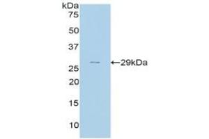 Detection of Recombinant CFH, Rat using Polyclonal Antibody to Complement Factor H (CFH) (Complement Factor H antibody  (AA 975-1217))