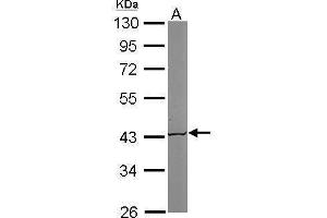 WB Image Sample (50 ug of whole cell lysate) A: Mouse brain 10% SDS PAGE antibody diluted at 1:1000 (ACAT1 antibody  (N-Term))