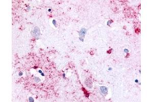 Immunohistochemical staining of Brain (Neurons and Glia) using anti- PAK6 antibody ABIN122606