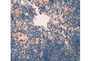 IHC-P analysis of spleen tissue, with DAB staining. (NAIP antibody  (AA 500-759))
