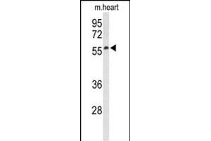 Western blot analysis of Sestrin-1 Antibody (N-term) (ABIN652375 and ABIN2841779) in mouse heart tissue lysates (35 μg/lane).