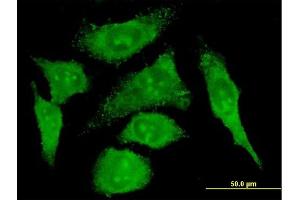 Immunofluorescence of monoclonal antibody to S100A10 on HeLa cell. (S100A10 antibody  (AA 1-97))