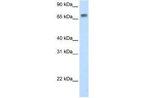 WB Suggested Anti-Mta2 Antibody Titration:  0. (MTA2 antibody  (N-Term))