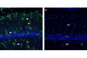 Expression of C5aR2 in rat hippocampus. (GPR77 antibody  (Extracellular))