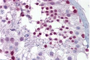 Immunohistochemistry with Testis tissue at an antibody concentration of 5µg/ml using anti-PITX3 antibody (ARP33033_P050) (PITX3 antibody  (N-Term))