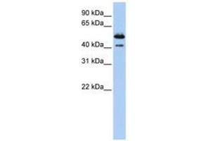 Image no. 1 for anti-Deoxyribonuclease II beta (DNASE2B) (AA 288-337) antibody (ABIN6740777) (DNASE2B antibody  (AA 288-337))