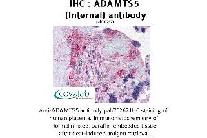 Image no. 1 for anti-ADAM Metallopeptidase with thrombospondin Type 1 Motif, 5 (ADAMTS5) (Internal Region) antibody (ABIN1731535) (ADAMTS5 antibody  (Internal Region))