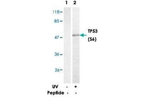 Western blot analysis of extracts from HT-29 cells treated with UV (20 min) using TP53 (phospho S6) polyclonal antibody . (p53 antibody  (pSer6))