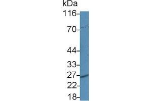 Detection of PSMa5 in Hela cell lysate using Polyclonal Antibody to Proteasome Subunit Alpha Type 5 (PSMa5) (PSMA5 antibody  (AA 1-241))