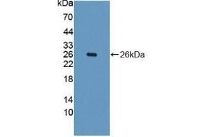 Detection of PAH in Reombinant PAH, Human using Polyclonal Antibody to Phenylalanine Hydroxylase (PAH) (Phenylalanine Hydroxylase antibody  (AA 228-452))