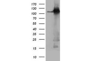 HEK293T cells were transfected with the pCMV6-ENTRY control (Left lane) or pCMV6-ENTRY BUB1B (Right lane) cDNA for 48 hrs and lysed. (BUB1B antibody)