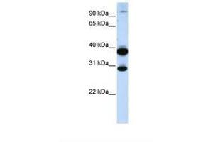 ZNF138 antibody  (C-Term)