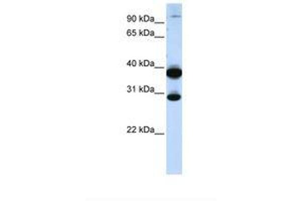 ZNF138 antibody  (C-Term)