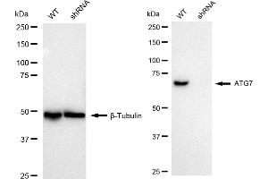 Western blotting analysis using ATG7 antibody (ABIN7797676). (Recombinant ATG7 antibody)
