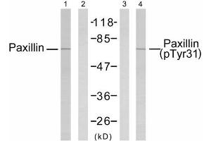 Western blot analysis of extracts from SK-OV3 cells untreated or estradiol-treated (0. (Paxillin antibody  (pTyr31))