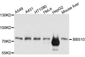 Western blot analysis of extract of various cells, using BBS10 antibody.