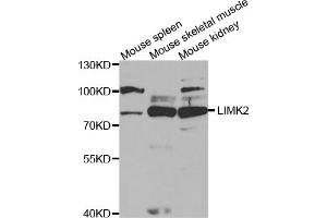Western blot analysis of extracts of various cell lines, using LIMK2 antibody (ABIN5973137) at 1/1000 dilution. (LIMK2 antibody)